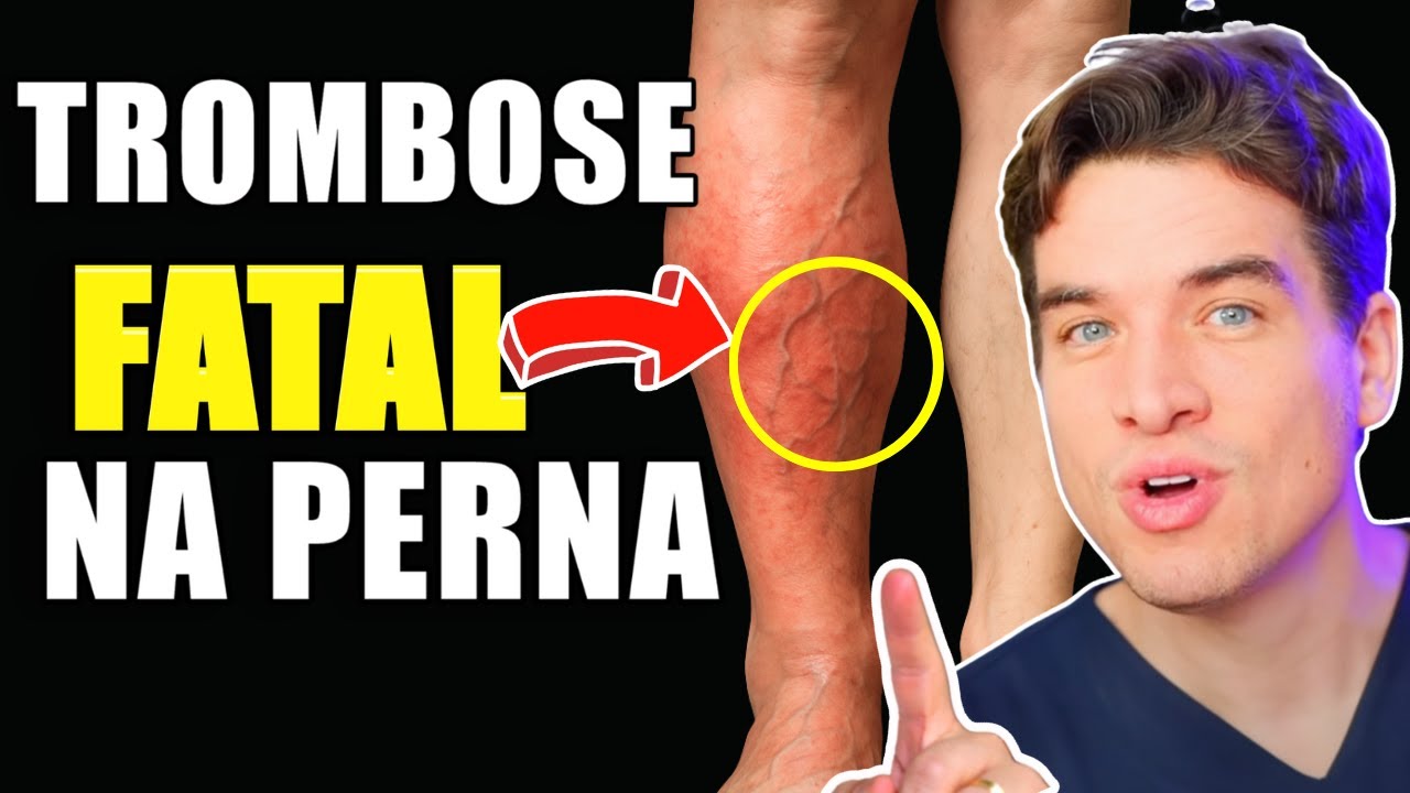 DON'T DIE FROM THROMBOSIS! | 7 PROVEN WAYS to IMPROVE CIRCULATION and PREVENT LEG CLOTS