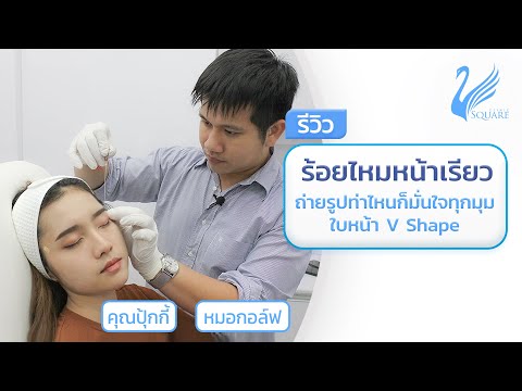 ร้อยไหม หน้าเรียว