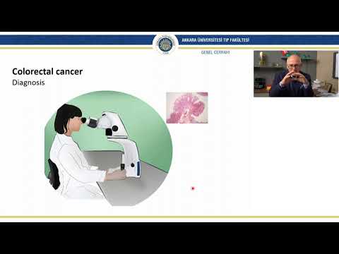 Surgical Management of Colorectal Cancer