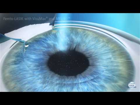 comment soigner hypermetropie