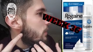 Minoxidil Beard | Week 36 | The Experiment | #Facialfuzzfridays