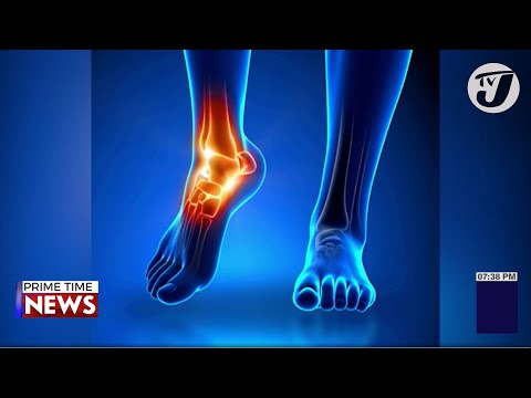 Overuse Injuries Early Diagnosis is Crucial with Dr. Michael Harvey TVJ News