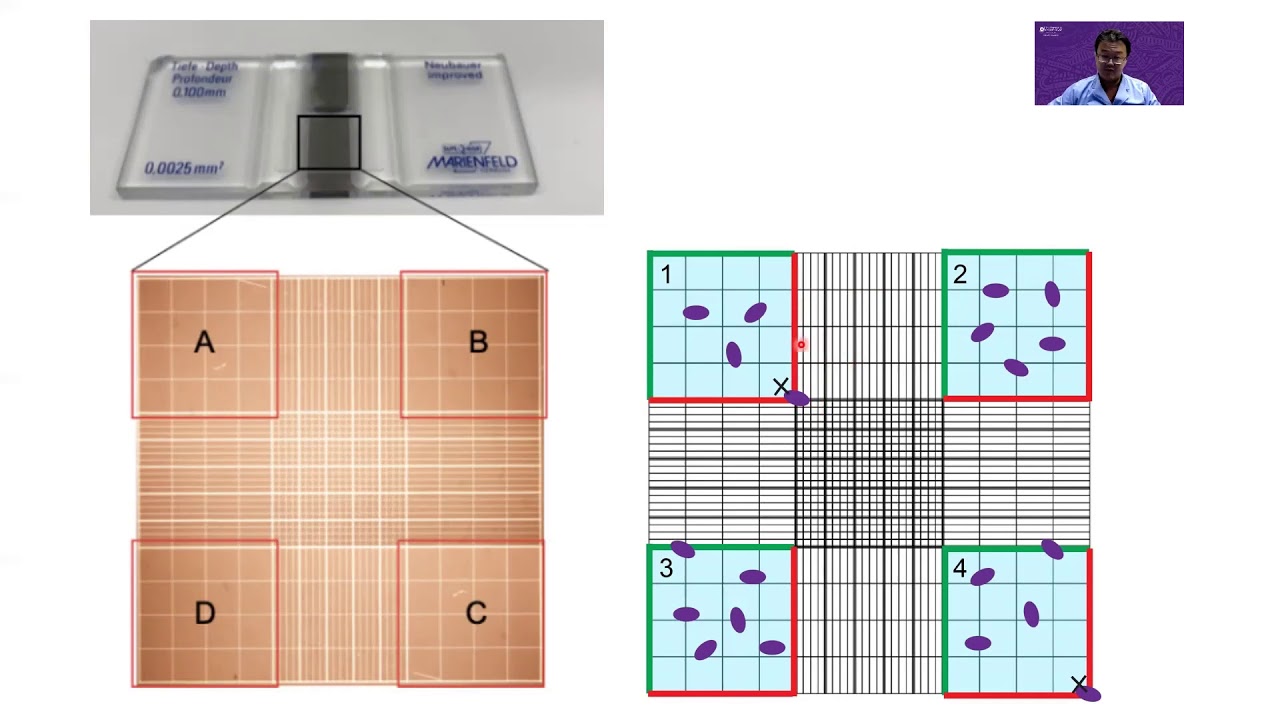 Counting cells on a hemocytometer