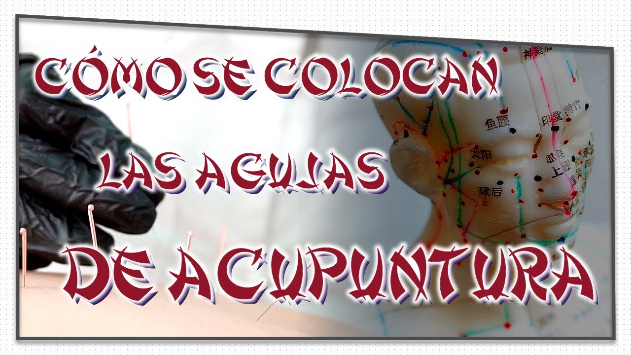 Watch 🌟¿Cómo se COLOCAN y por cuánto TIEMPO las agujas de ACUPUNTURA💖 Now 🌟¿Cómo se COLOCAN y por cuánto TIEMPO las agujas de ACUPUNTURA💖