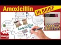 Amoxicillin 500mg Capsule: What is Amoxicillin Used For, Dosage, Contraindications & Precautions?