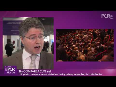 The COMPARE ACUTE trial: FFR guided complete revascularisation during primary angioplasty