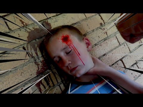 POVREDIO SE |  IGRAMO ĆORAVE BAKE