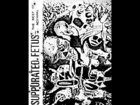 Suppurated Fetus - The Rest of Nothing - demo 1990