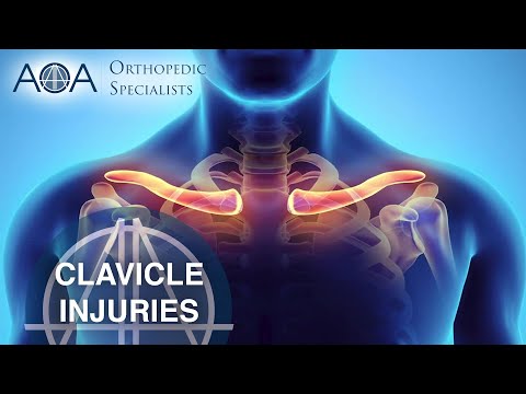 AOA Orthopedic Specialists - Clavicle Injuries