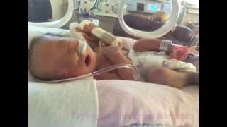 In Memory of Baby Rylee, a SWAN ( Syndrome without a name) Baby