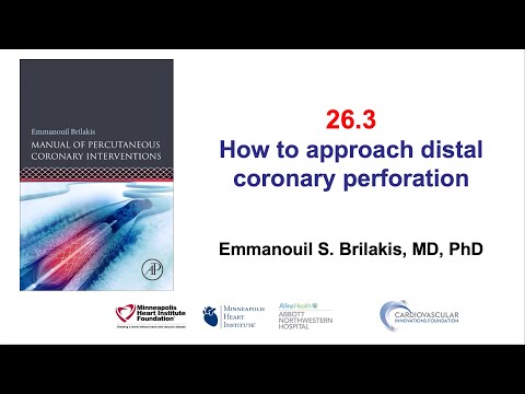 26.3 Manual of PCI - Distal vessel perforation