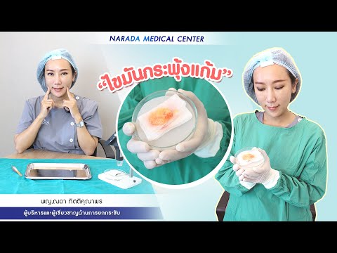 ลดไขมันถาวร ด้วยการตัดไขมันกระพุ้งแก้มแบบไร้แผลเป็น ที่ นารดาคลินิก ลดไขมันถาวร ด้วยการตัดไขมันกระพุ้งแก้มแบบไร้แผลเป็น ที่ นารดาคลินิก