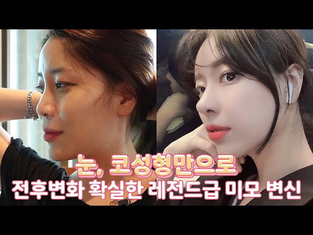 젊은감각! 프리미어성형외과 젊은감각! 프리미어성형외과