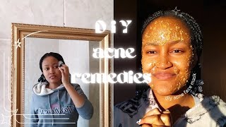 *AFFORDABLE* Skincare For Acne & Dark Spots