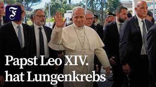 Ärzte entfernen Teil des rechten Lungenflügels