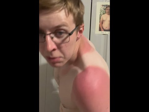 Day 164, abusive relationship with Sun