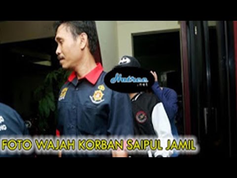 Inilah Sosok DS Korban Pelecehan Saipul Jamil Gossip Hari ini Video