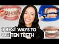 3 Best Ways To Whiten Teeth Dental Hygienist Explains