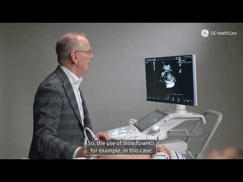 How to bring the color doppler to the next level with only one click? 