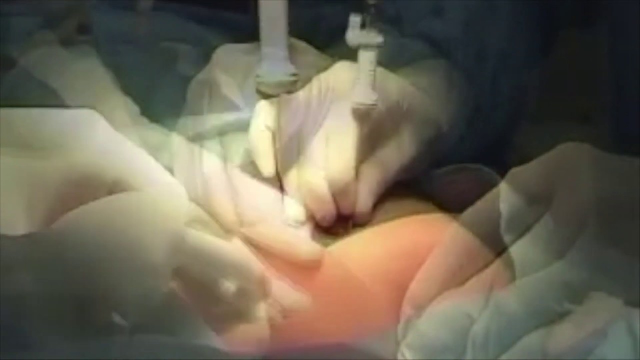 Ruben Tlapanco Vargas-28