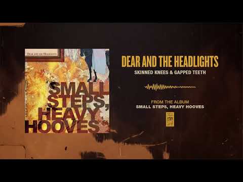 Skinned Knees & Gapped Teeth - Dear and the Headlights