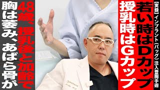 【実録】若い時はDカップ！授乳時はGカップ！48歳、授乳と加齢で胸はしぼみあばら骨が、、、もう一度ハリのある若々しい胸を取り戻したい【ドクターA（麻生手術）】