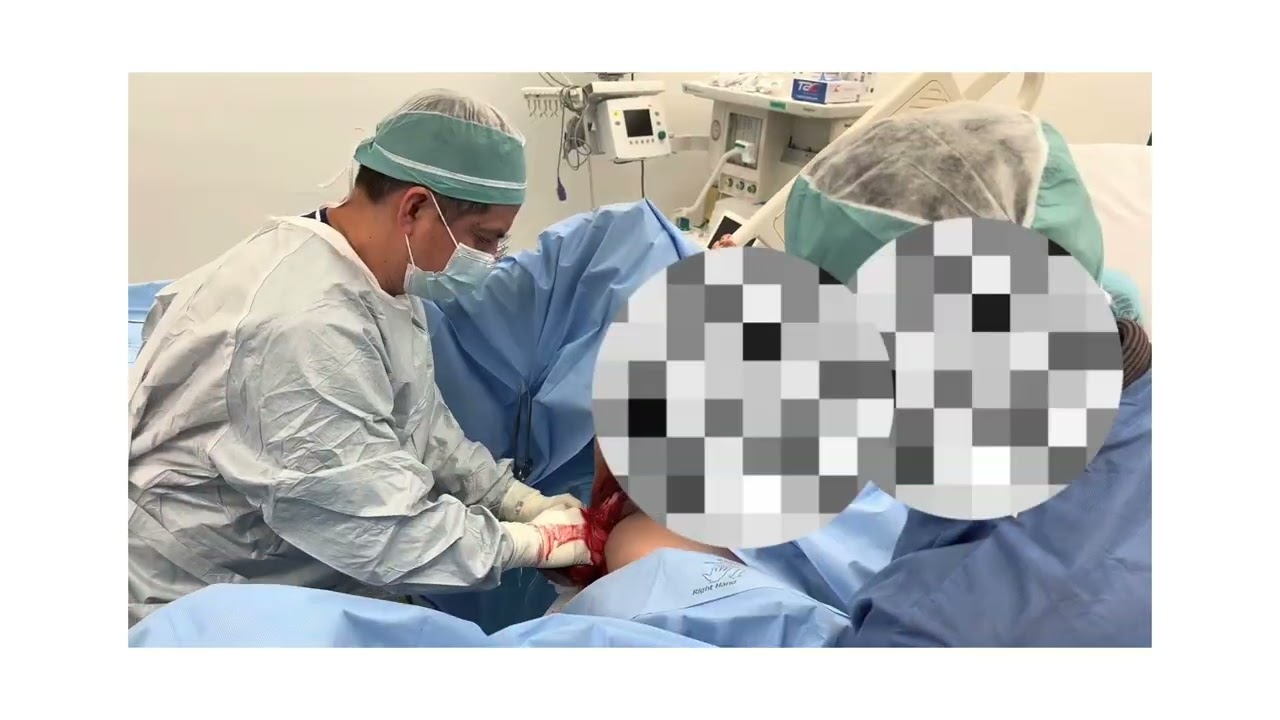 Ángel Millán Juárez-96