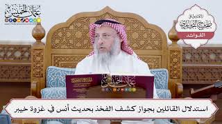 [187] استدلال القائلين بجواز كشف الفخذ بحديث أنس في غزوة خيبر - عثمان الخميس