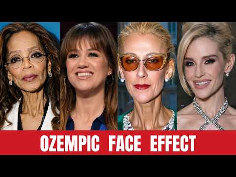 20 Celebrities With Ozempic Face | Then And Now 2026