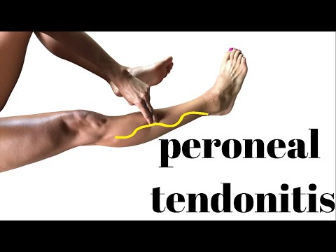 Peronealsehnenentzündung