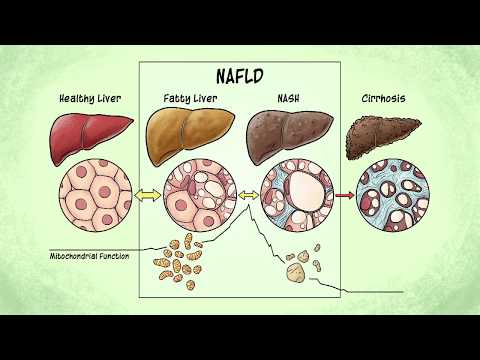 Introducing FOIE GRAS: Bioenergetic Remodeling in NAFLD