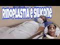 MINHA CIRURGIA RINOPLASTIA E SILICONE Olha No Que Deu DIARIO DE CIRURGIA