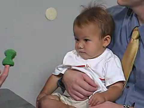 Neuro exam 12 Month: Cranial Nerves