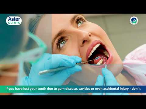 download lagu mp3 mp4 Dental Implants Uae, download lagu Dental Implants Uae gratis, unduh video klip Dental Implants Uae
