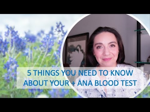5 Things You Need To Know About Your Positive ANA