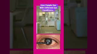 How People See With Different Eye Conditions: #diabetic retinopathy #glaucoma #cataract