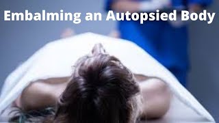 Embalming an autopsied body