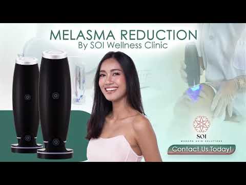 Melasma Reduction at SOI Clinic
