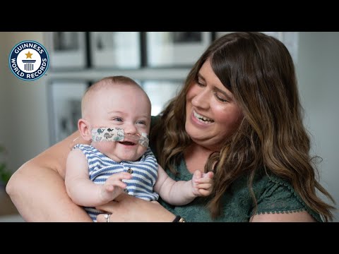 Most PREMATURE Babies | Guinness World Records