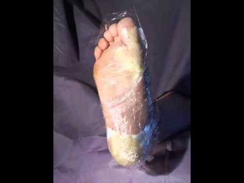 comment appliquer lotion