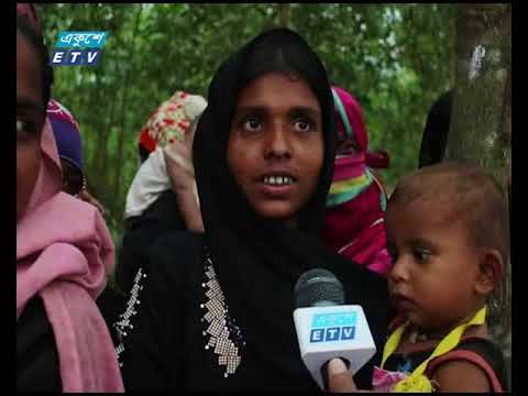 রোহিঙ্গা ক্যাম্পের ১ লাখ ৭৬ হাজার শিশু অপুষ্টিজনিত বিভিন্ন রোগে ভুগছে