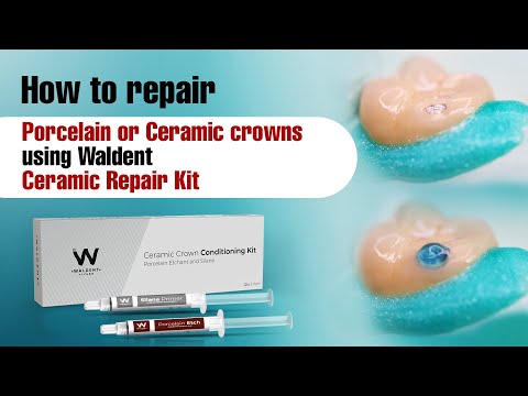 How to repair Porcelain or Ceramic crowns using Waldent Ceramic Repair Kit