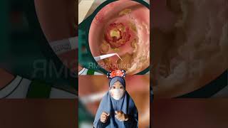 Download lagu ASMR part 62 Fluid Coming Out of Ear π± |Mv #shorts mp3 Download lagu ASMR part 62 Fluid Coming Out of Ear π± |Mv #shorts mp3