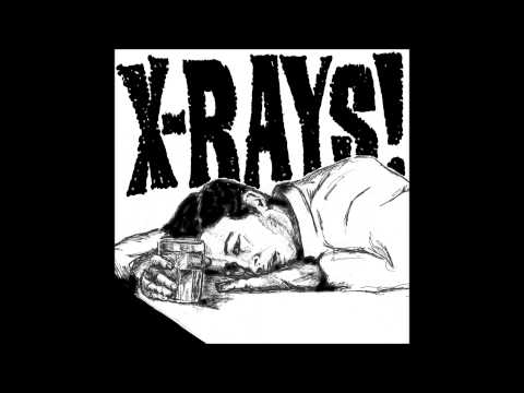 X-rays Jameson Shot (Big Neck Records 2013)