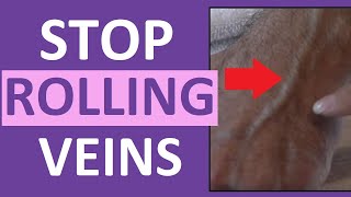 Prevent a Rolling Vein When Starting an IV or Drawing Blood