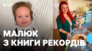 Трехмесячный мальчик из Житомирщины попал в Нацреестр рекордов из-за роскошной шевелюры (фото)