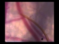 Po mikroskopu: pirmąsyk nufilmuota, kaip uodas siurbia kraują