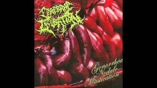 Cerebral Incubation - Gonhorrea Nodule Mastication (Full Album) 2012 (HD)