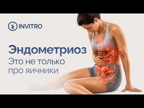 Эндометриоз: болезнь, которую слишком часто игнорируют, даже сами пациентки