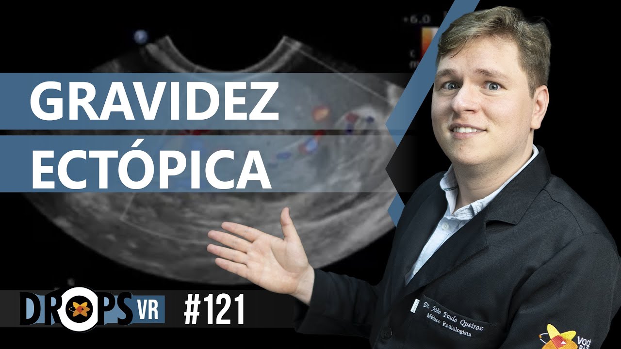 GRAVIDEZ ECTÓPICA NO ULTRASSOM